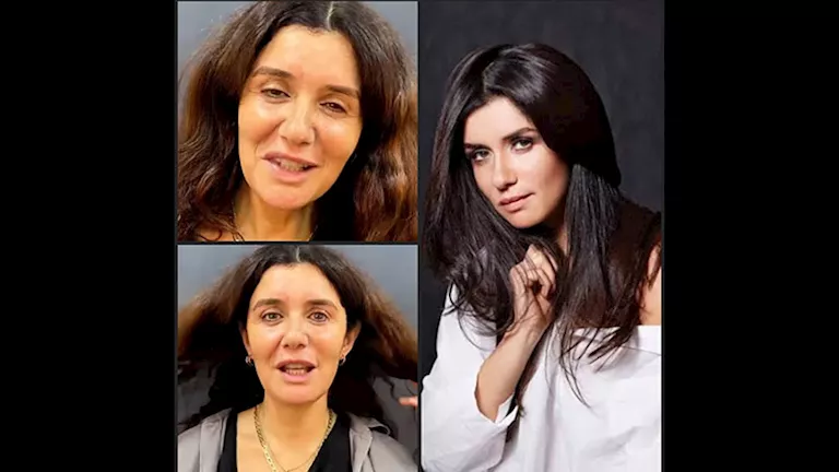 بالفيديو والصور.. غادة عادل قبل وبعد عملية تجميل "شد الوجه"