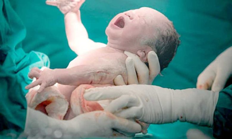 «الولادة القيصرية».. «بيزنس» يهدد الصحة الإنجابية للأمهات