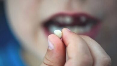 تفسير حلم سقوط الأسنان