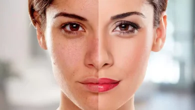 تبيض الوجه.webp