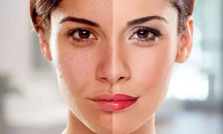 تبيض الوجه.webp