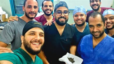 استخراج 58 حصوة من الكلية اليسرى لمريض أربعيني بمستشفى المعبر الجامعي بقنا