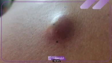 كيس دهني.webp