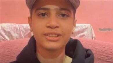 صاحب اول عملية زراعة جلد